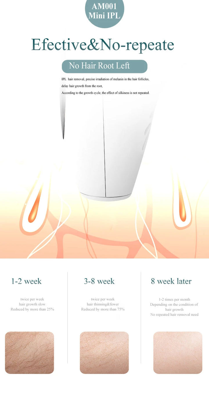 Professional Permanent Laser Depilatory Hair Remover